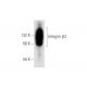 Integrin β2/ITGB2/CD18 Antibody (MEM-48) - Western Blotting - Image 62624