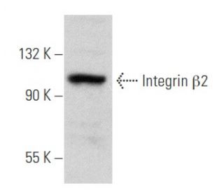 Integrin &beta;2/ITGB2/CD18 Antibody (P4H9) - Western Blotting - Image 354818 