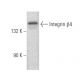 Integrin β4/ITGB4/CD104 Antibody (A9) - Western Blotting - Image 354493