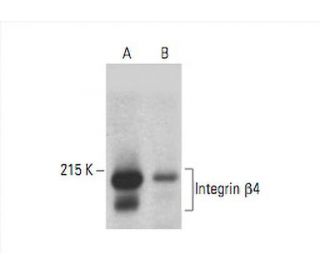 Integrin &beta;4/ITGB4/CD104 Antibody (G-7) - Western Blotting - Image 392835 