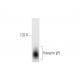 Integrin β5/ITGB5 Antibody (4AK) - Western Blotting - Image 56938