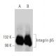 Integrin β5/ITGB5 Antibody (B-1) - Western Blotting - Image 356167 