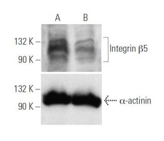 Integrin &beta;5 siRNA (h): sc-35680. Western blot analysis of Integrin &beta;5 expression in non-transfected control (A) 