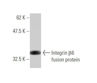 Integrin &beta;6/ITGB6 Antibody (4C3) - Western Blotting - Image 348526