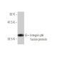 Integrin β6/ITGB6 Antibody (4C3) - Western Blotting - Image 348526