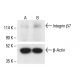 Integrin β7/ITGB7 Antibody (LS722) - Western Blotting - Image 411783