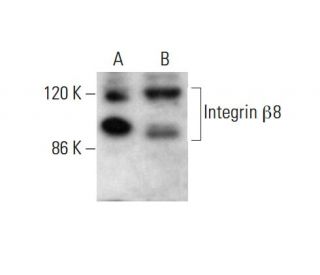 Integrin &beta;8/ITGB8 Antibody (E-6) - Western Blotting - Image 382858 