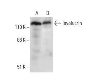 involucrin Antibody (H-8) - Western Blotting - Image 303352 