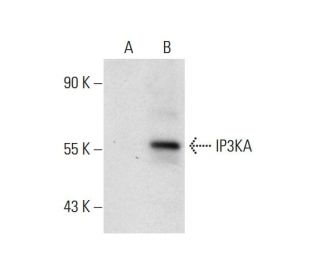 IP3KA Antibody (F-3) - Western Blotting - Image 144961 