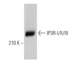 IP3R-I/II/III Antibody (B-2) - Western Blotting - Image 361086The Double Nickase Plasmid features a U6 promoter for sgRNA expression, a 20 nt targeting sequence, and a gRNA scaffold to guide Cas9n. It includes a CBh promoter for Cas9n (D10A) and puromycin resistance, GFP for transfection verification, and nuclear localization signals (NLS). The 2A peptide allows co-expression of Cas9n and Puro from a single promoter, enabling precise genome editing with reduced off-target effects.