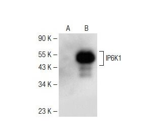 IP6K1 Antibody (A-10) - Western Blotting - Image 149662 
