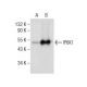 IP6K1 Antibody (E-11) - Western Blotting - Image 155051