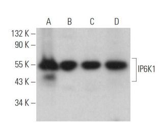 IP6K1 Antibody (E-11) - Western Blotting - Image 374844 