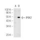 IP6K2 Antibody (4F10) - Western Blotting - Image 50272