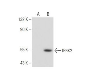 IP6K2 Antibody (4F10) - Western Blotting - Image 138922 