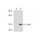 IP6K2 Antibody (4F10) - Western Blotting - Image 138922 