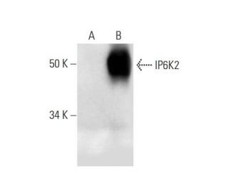 IP6K2 Antibody (E-3) - Western Blotting - Image 291014