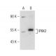 IP6K2 Antibody (G-9) - Western Blotting - Image 147311