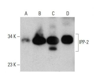 IPP-2 Antibody (70.5) - Western Blotting - Image 384534 
