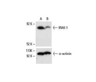 IRAK-1 Antibody (F-4) - Western Blotting - Image 6849 