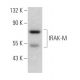IRAK-M Antibody (XX-6) - Western Blotting - Image 366685