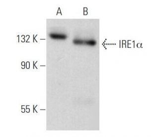 IRE1&alpha; Antibody (B-12) - Western Blotting - Image 353682 