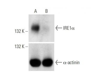 IRE1a CRISPR/Cas9 KO Plasmid (h): sc-400576. Western blot analysis of human IRE1a expression in empty vector control (A) a 