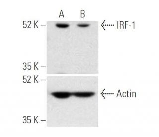 IRF-1 siRNA (h): sc-35706. Western blot analysis of IRF-1 expression in non-transfected control (A) and IRF-1 siRNA transf 