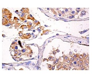 IRF3 Antibody (D-3) - Immunohistochemistry - Image 157933 