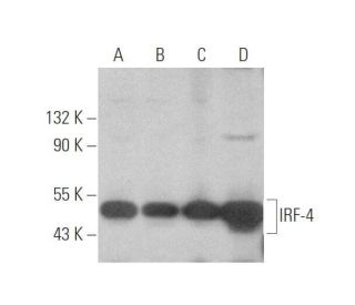 IRF-4 Antibody (3E4) - Western Blotting - Image 349974 