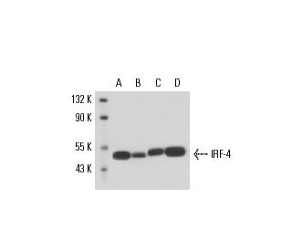 IRF-4 Antibody (MUM1p) - Western Blotting - Image 17108 