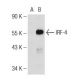 IRF-4 Antibody (MUM1p) - Western Blotting - Image 126145