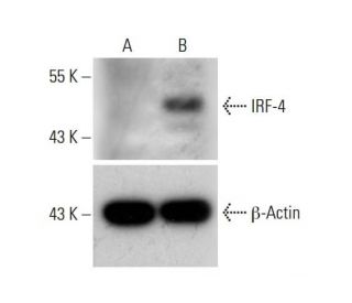 IRF-4 CRISPR Activation Plasmid (h): sc-400288-ACT. Western blot analysis of IRF-4 expression in non-transfected control ( 