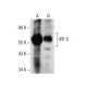 IRF-5 Antibody (D-10) - Western Blotting - Image 287862 
