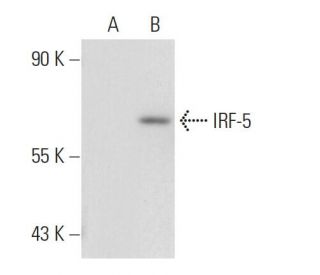 IRF-5 Antibody (10T1) - Western Blotting - Image 82466The Double Nickase Plasmid features a U6 promoter for sgRNA expression, a 20 nt targeting sequence, and a gRNA scaffold to guide Cas9n. It includes a CBh promoter for Cas9n (D10A) and puromycin resistance, GFP for transfection verification, and nuclear localization signals (NLS). The 2A peptide allows co-expression of Cas9n and Puro from a single promoter, enabling precise genome editing with reduced off-target effects.