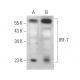 IRF-7 Antibody (F-1) - Western Blotting - Image 375104 
