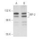 IRP-2 Antibody (4G11) - Western Blotting - Image 356154 