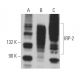 IRP-2 Antibody (4G11) - Western Blotting - Image 363407