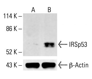 IRSp53 Antibody (46) - Western Blotting - Image 412901The Double Nickase Plasmid features a U6 promoter for sgRNA expression, a 20 nt targeting sequence, and a gRNA scaffold to guide Cas9n. It includes a CBh promoter for Cas9n (D10A) and puromycin resistance, GFP for transfection verification, and nuclear localization signals (NLS). The 2A peptide allows co-expression of Cas9n and Puro from a single promoter, enabling precise genome editing with reduced off-target effects.