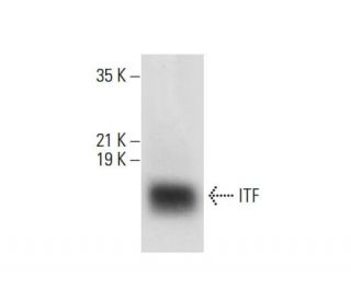 ITF Antibody (B-1) - Western Blotting - Image 308010Each CRISPR/Cas9 Knockout (KO) Plasmid product consists of a pool of 3 plasmids designed to ensure identification and cleavage of a specific gene for maximum knockout efficiency. Each plasmid encodes a unique 20 nt sequence derived from the GeCKO (v2) library.