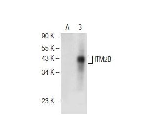 ITM2B Antibody (E-11) - Western Blotting - Image 146820 