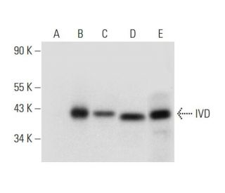 IVD Antibody (A-8) - Western Blotting - Image 318320 