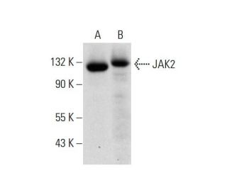 JAK2 Antibody (C-10) - Western Blotting - Image 320285SAM Transcription Activation: SAM system utilizing dCas9-VP64, MS2-P65-HSF1, and sgRNA for precise gene transcription activation. 