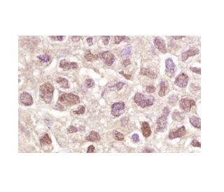 JAK3 Antibody (B-12) - Immunohistochemistry - Image 153291 
