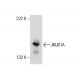 JMJD1A Antibody (C-6) - Western Blotting - Image 157528