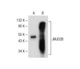 JMJD2B Antibody (F-12) - Western Blotting - Image 149472 