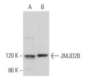JMJD2B Antibody (F-12) - Western Blotting - Image 364057Each CRISPR/Cas9 Knockout (KO) Plasmid product consists of a pool of 3 plasmids designed to ensure identification and cleavage of a specific gene for maximum knockout efficiency. Each plasmid encodes a unique 20 nt sequence derived from the GeCKO (v2) library.