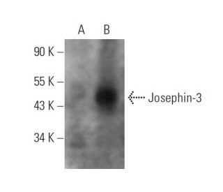 Josephin-3 Antibody (B-10) - Western Blotting - Image 344313 