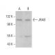 JRAB Antibody (F-5) - Western Blotting - Image 376615
