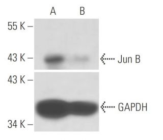Jun B siRNA (h): sc-35726. Western blot analysis of Jun B expression in non-transfected control (A) and Jun B siRNA transf 